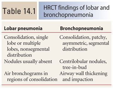 bronchopneumonia vs lobar pneumonia