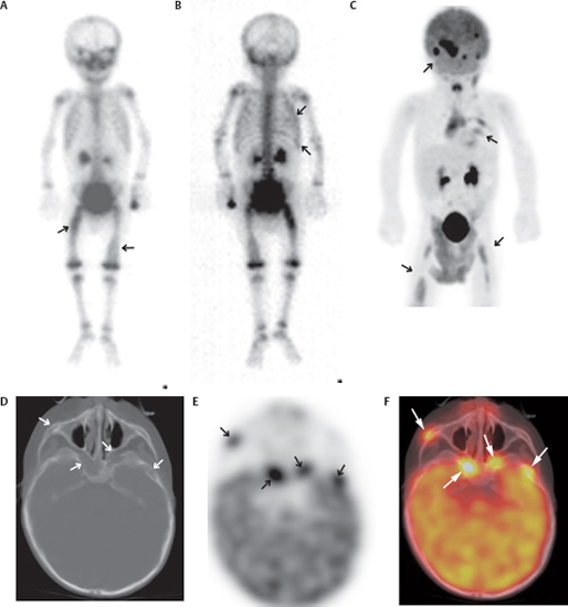 The Physics of PET/CT Scanners | Radiology Key