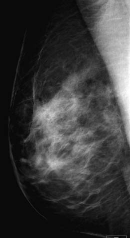 The breast  Radiology Key
