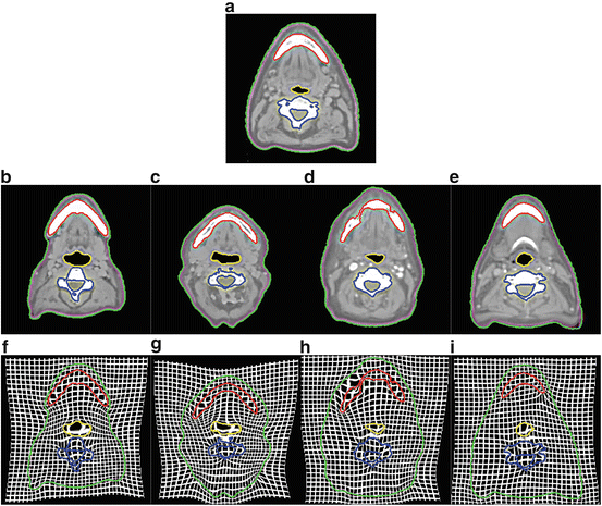 Segmentation Radiology Key