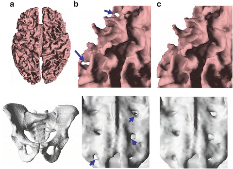 A151032_1_En_5_Fig2_HTML.gif