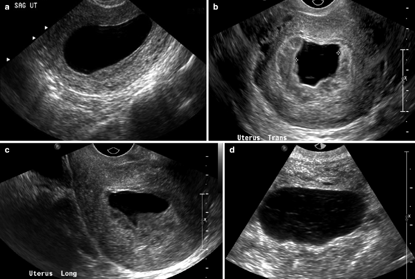 imaging-of-acute-obstetric-disorders-radiology-key