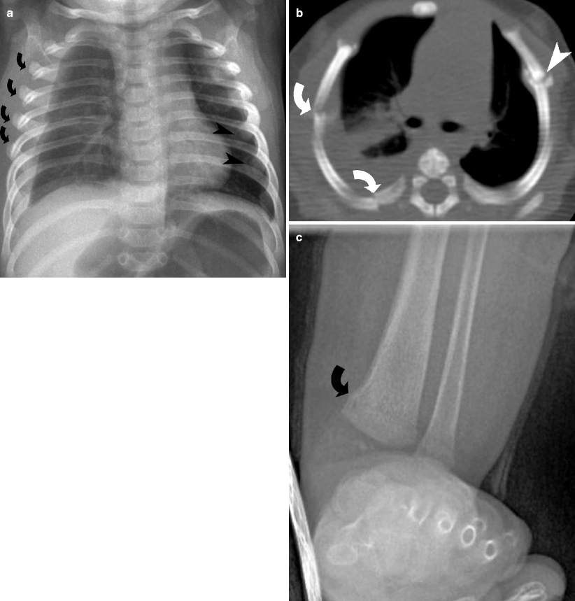 Lower Extremity Trauma | Radiology Key
