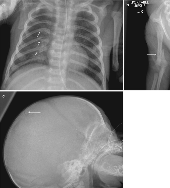 Pediatrics | Radiology Key