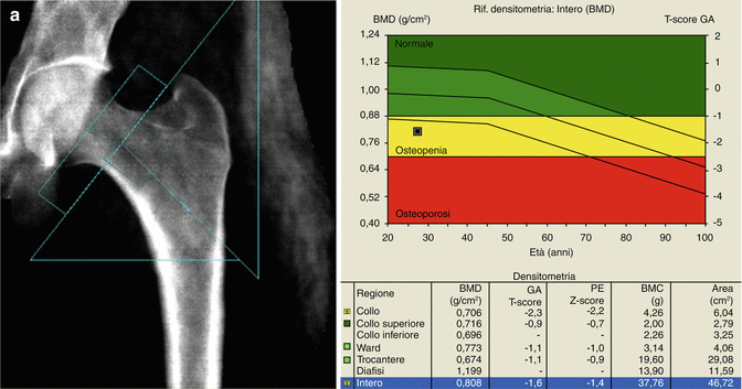 DEXA Bone Density  Arthritis & Sports
