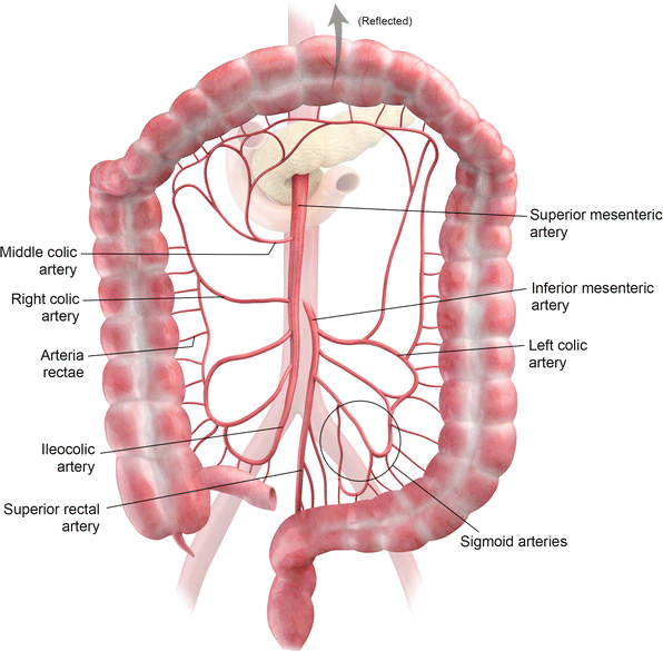 Approach To Colon Pathologies Radiology Key 