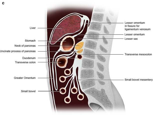 Omental Cakes: Unusual Aetiologies and CT Appearances Share Your Story