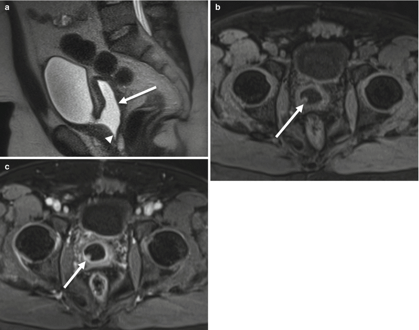 The Urinary Tract Renal Collecting Systems Ureters And Urinary Bladder Radiology Key 7564