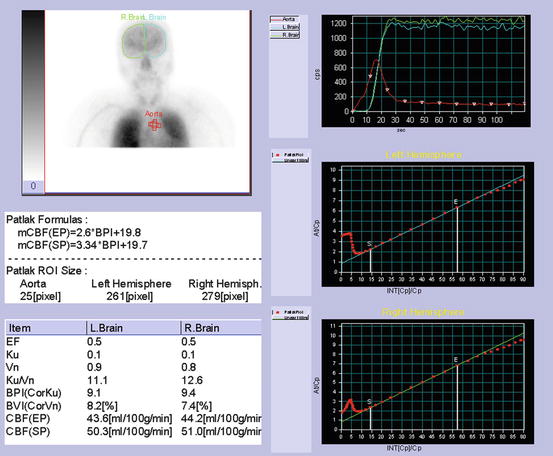 A308863_1_En_4_Fig2_HTML.jpg