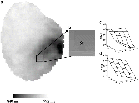 A320817_1_En_13_Fig4_HTML.gif