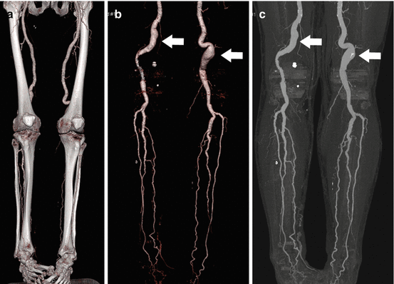 upper-and-lower-limb-imaging-radiology-key