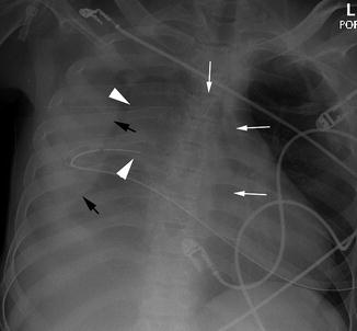 Trauma | Radiology Key