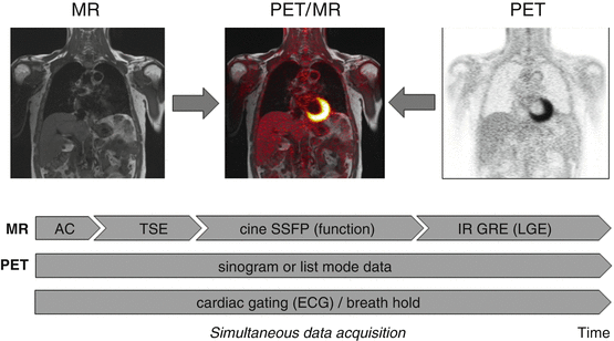 PET/MRI: Physics, Instrumentation, And Systems | Radiology Key