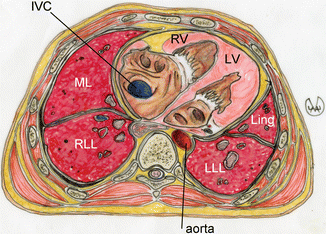 The Mediastinum & Anatomy of the Heart (CR1) Flashcards