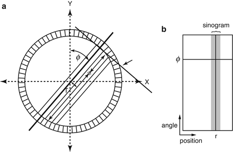 A81660_3_En_3_Fig3_HTML.gif