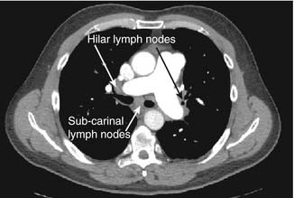 The CT scan | Radiology Key