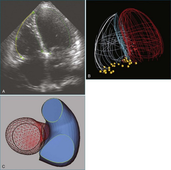 Assessment of Right Ventricular Function | Radiology Key