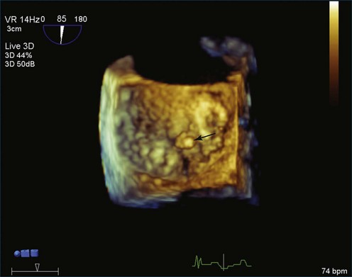 VIDEO: Can We Live in 3-D Echo?