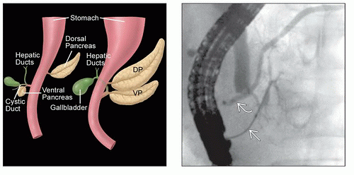 Imaging Approach to the Pancreas | Radiology Key