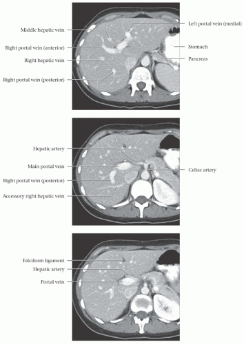 Liver Anatomy | Radiology Key