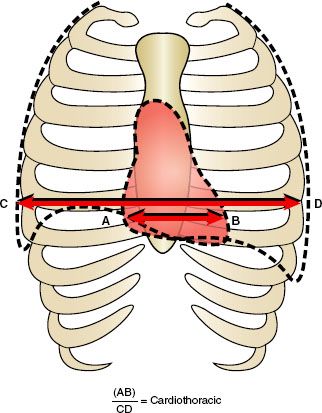 3 Chest Radiology Key 3 Chest Radiology Key