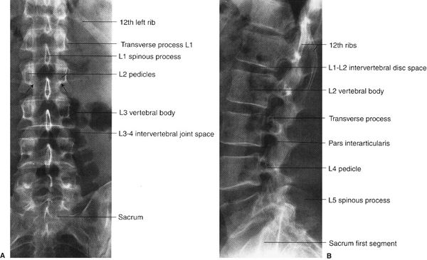 Spine and Pelvis | Radiology Key