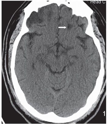 57 | Radiology Key