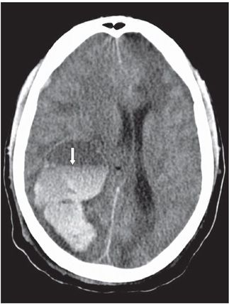 108 | Radiology Key