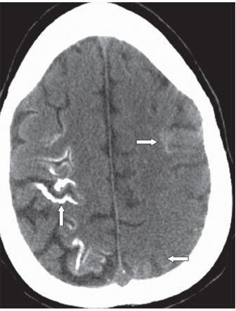 167 | Radiology Key