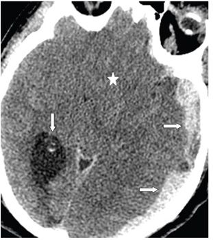 207 | Radiology Key