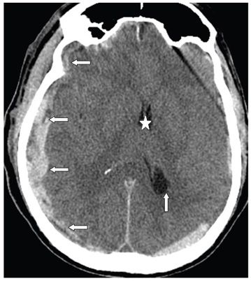 218 | Radiology Key