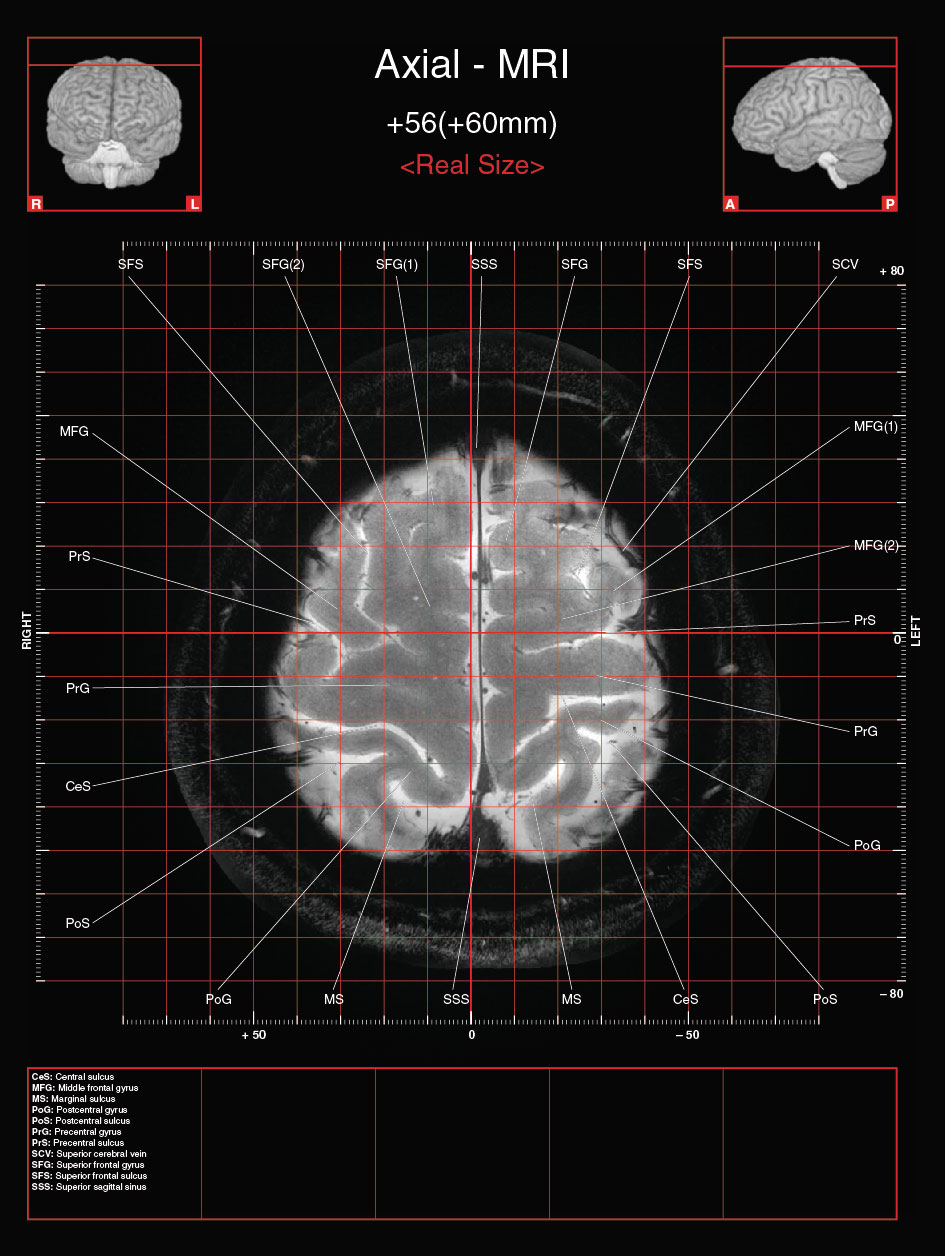 A182595_2_En_3_Fig10_HTML.jpg