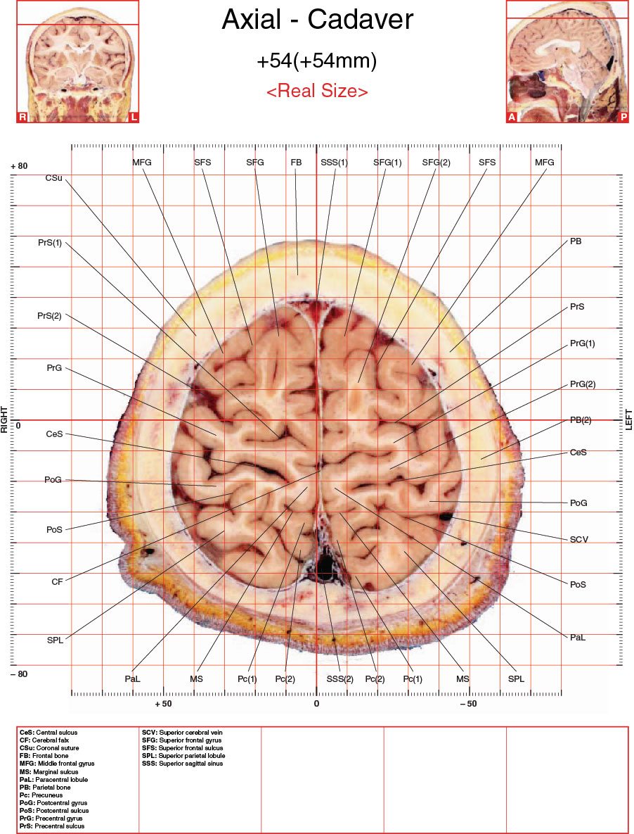 A182595_2_En_3_Fig11_HTML.jpg