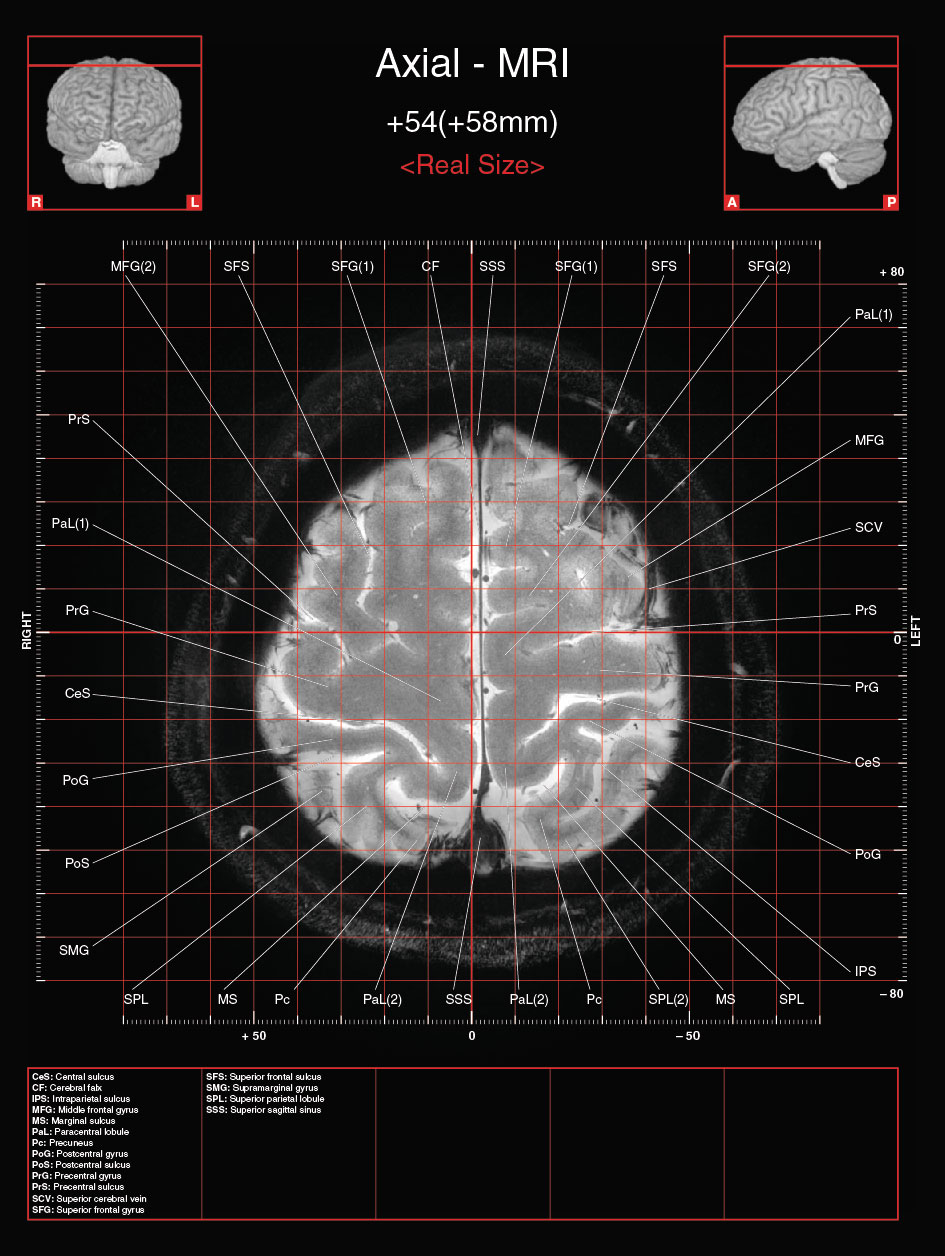 A182595_2_En_3_Fig12_HTML.jpg