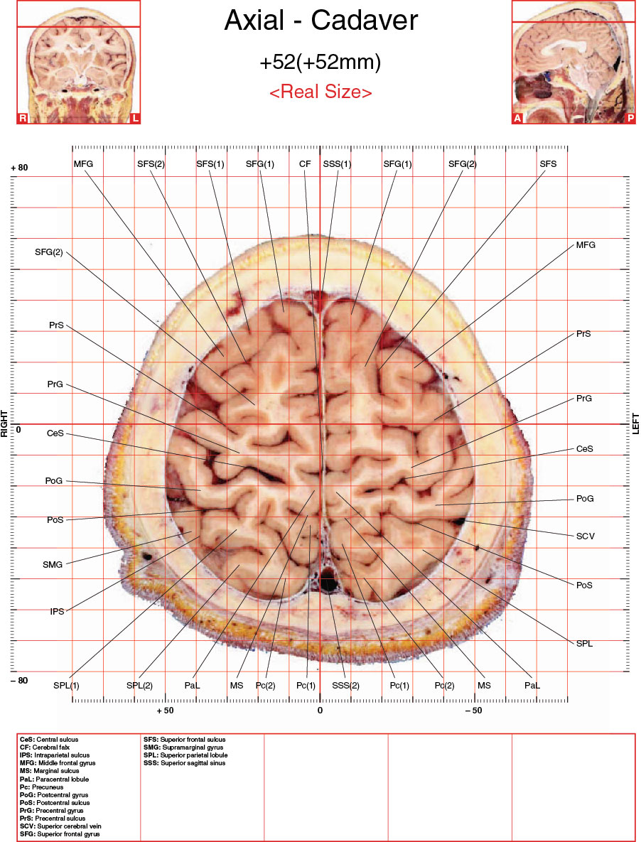 A182595_2_En_3_Fig13_HTML.jpg