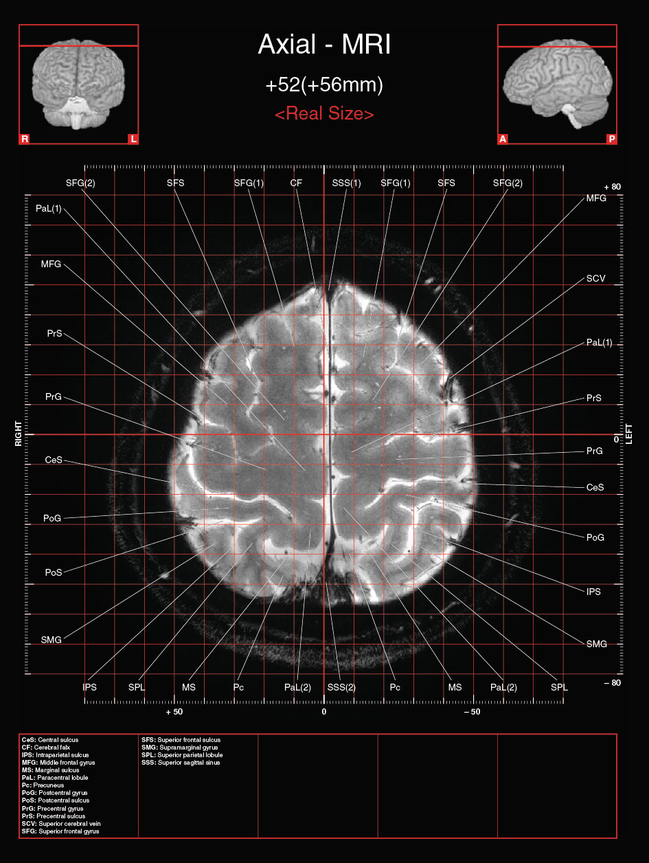 A182595_2_En_3_Fig14_HTML.jpg