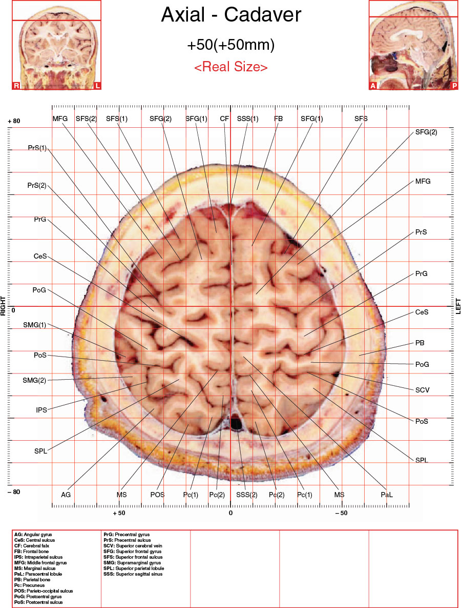 A182595_2_En_3_Fig15_HTML.jpg