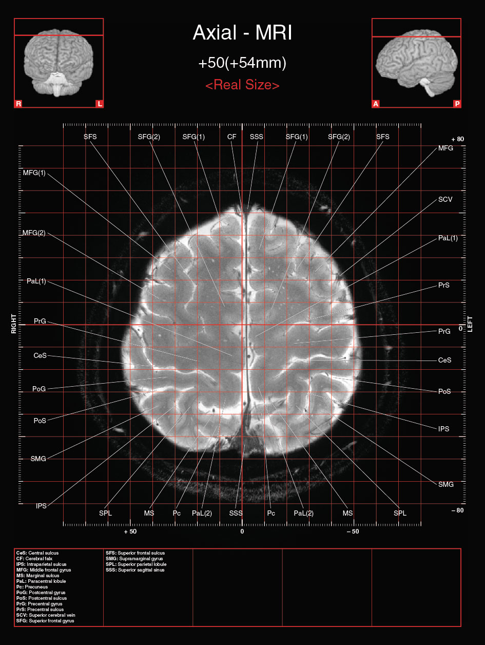 A182595_2_En_3_Fig16_HTML.jpg