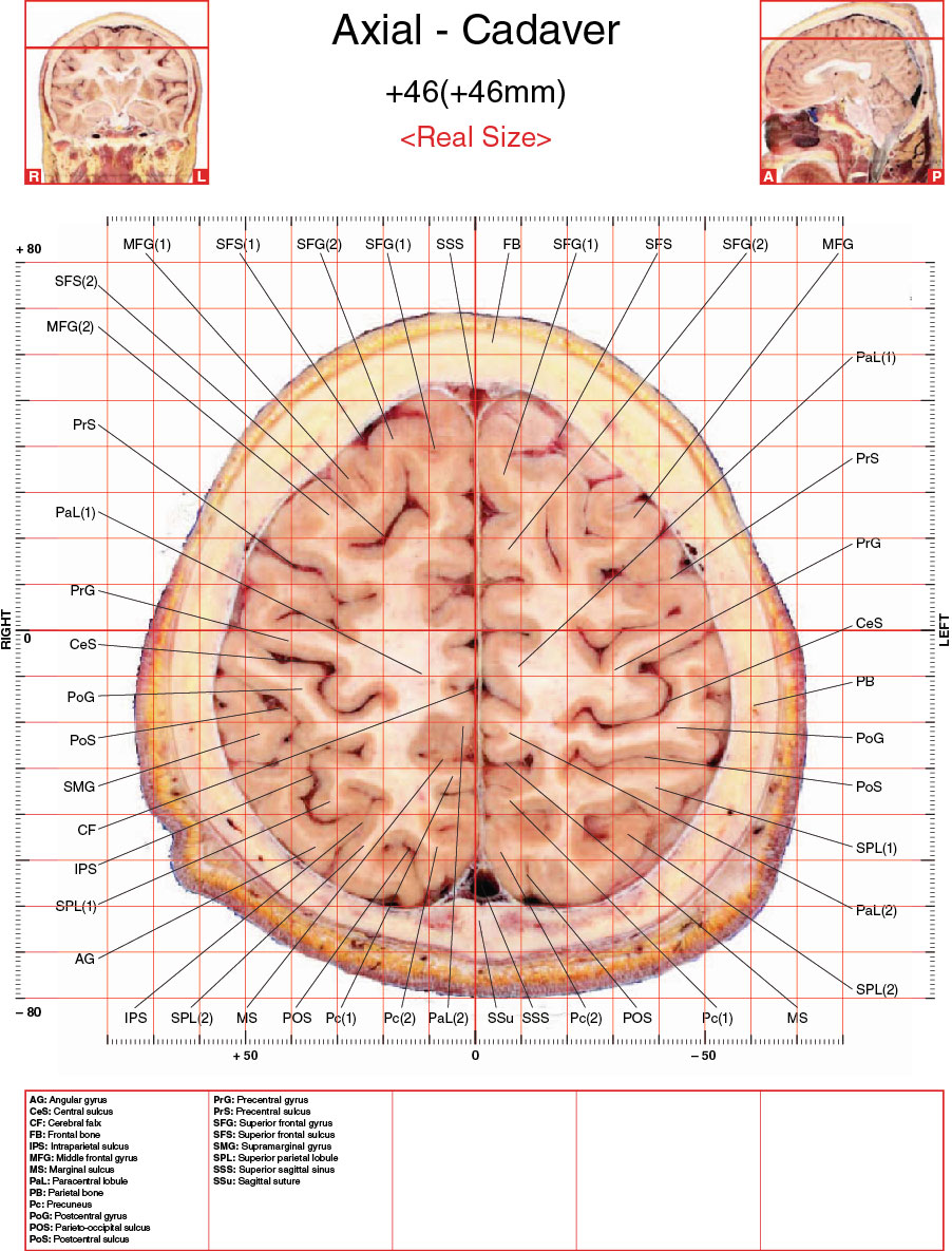 A182595_2_En_3_Fig19_HTML.jpg