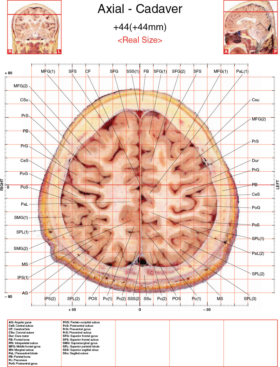 A182595_2_En_3_Fig21_HTML.jpg