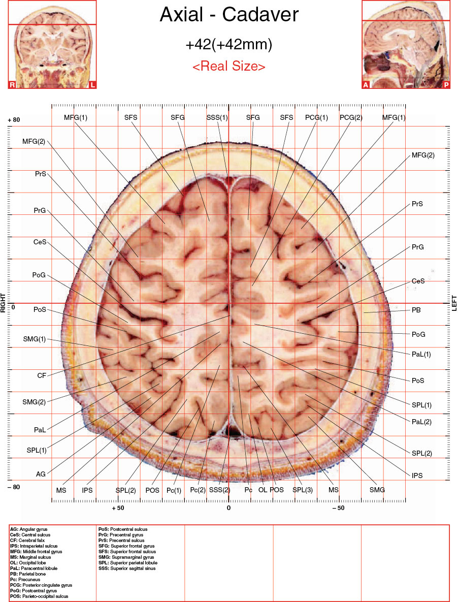 A182595_2_En_3_Fig23_HTML.jpg