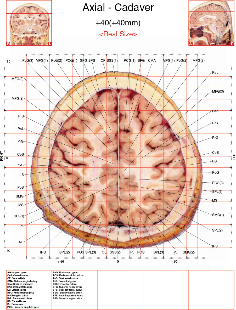 A182595_2_En_3_Fig25_HTML.jpg