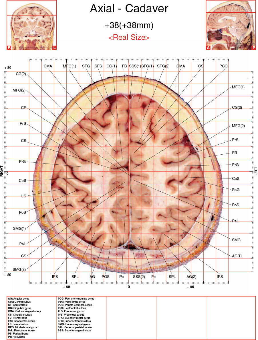 A182595_2_En_3_Fig27_HTML.jpg