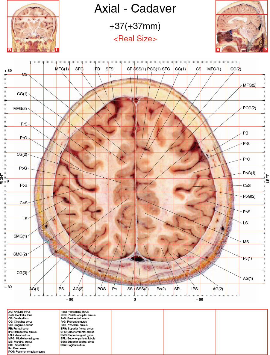 A182595_2_En_3_Fig29_HTML.jpg