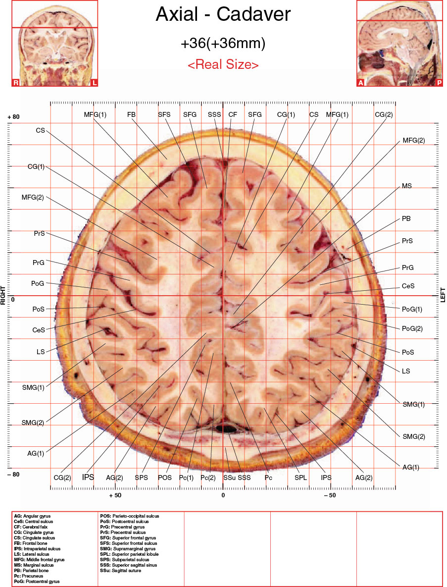 A182595_2_En_3_Fig31_HTML.jpg