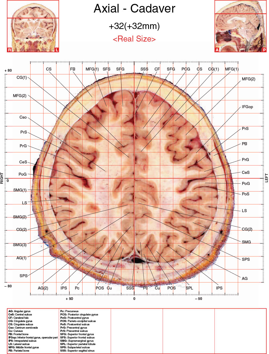 A182595_2_En_3_Fig35_HTML.jpg