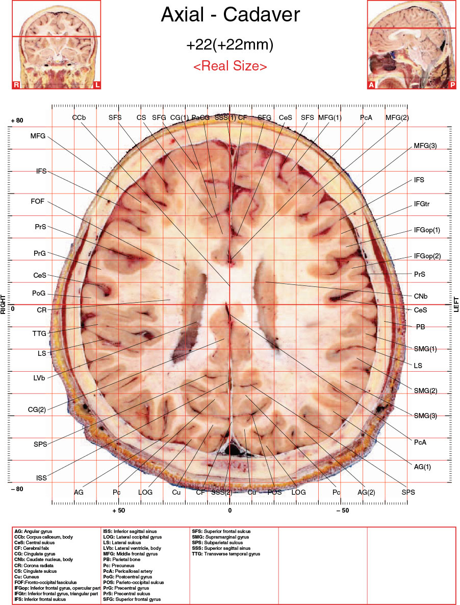 A182595_2_En_3_Fig47_HTML.jpg