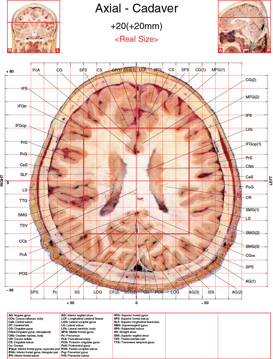 A182595_2_En_3_Fig49_HTML.jpg