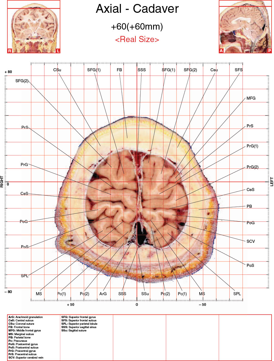 A182595_2_En_3_Fig5_HTML.jpg