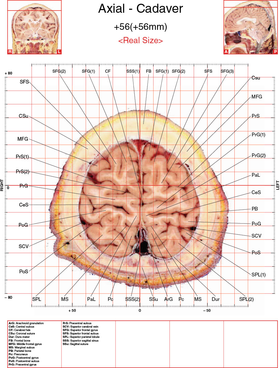 A182595_2_En_3_Fig9_HTML.jpg